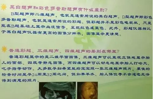 成都较详细打四维彩超攻略，值得收藏