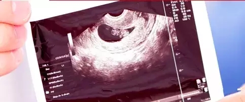 【美妈日记】我为什么愿意去私立医院生孩子？