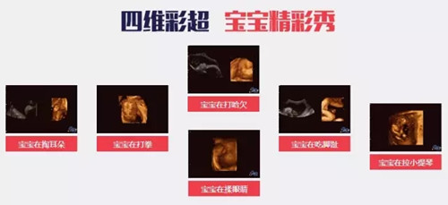 玛丽亚年终盛宴邀您共享 四维彩超名额免费送