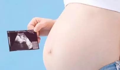 四维彩超获奖名单公布！