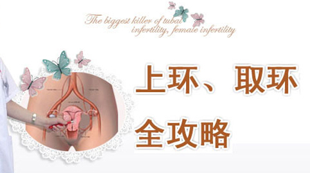 成都玛丽亚医院取环 专业妇产医院更安全！