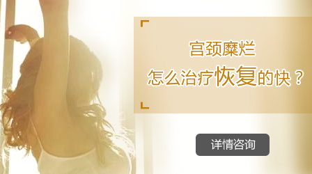 宫颈糜烂手术 都说这家医院不错