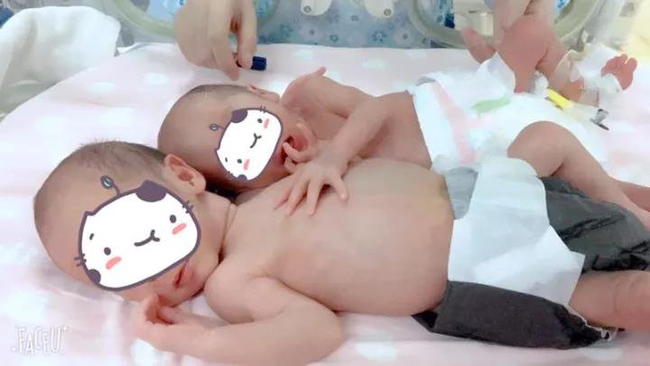 玛丽亚专家团队力保“珍贵儿”终圆孕妈母亲梦